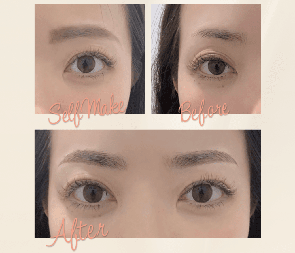 グロウクリニックのアートメイクのビフォアフター